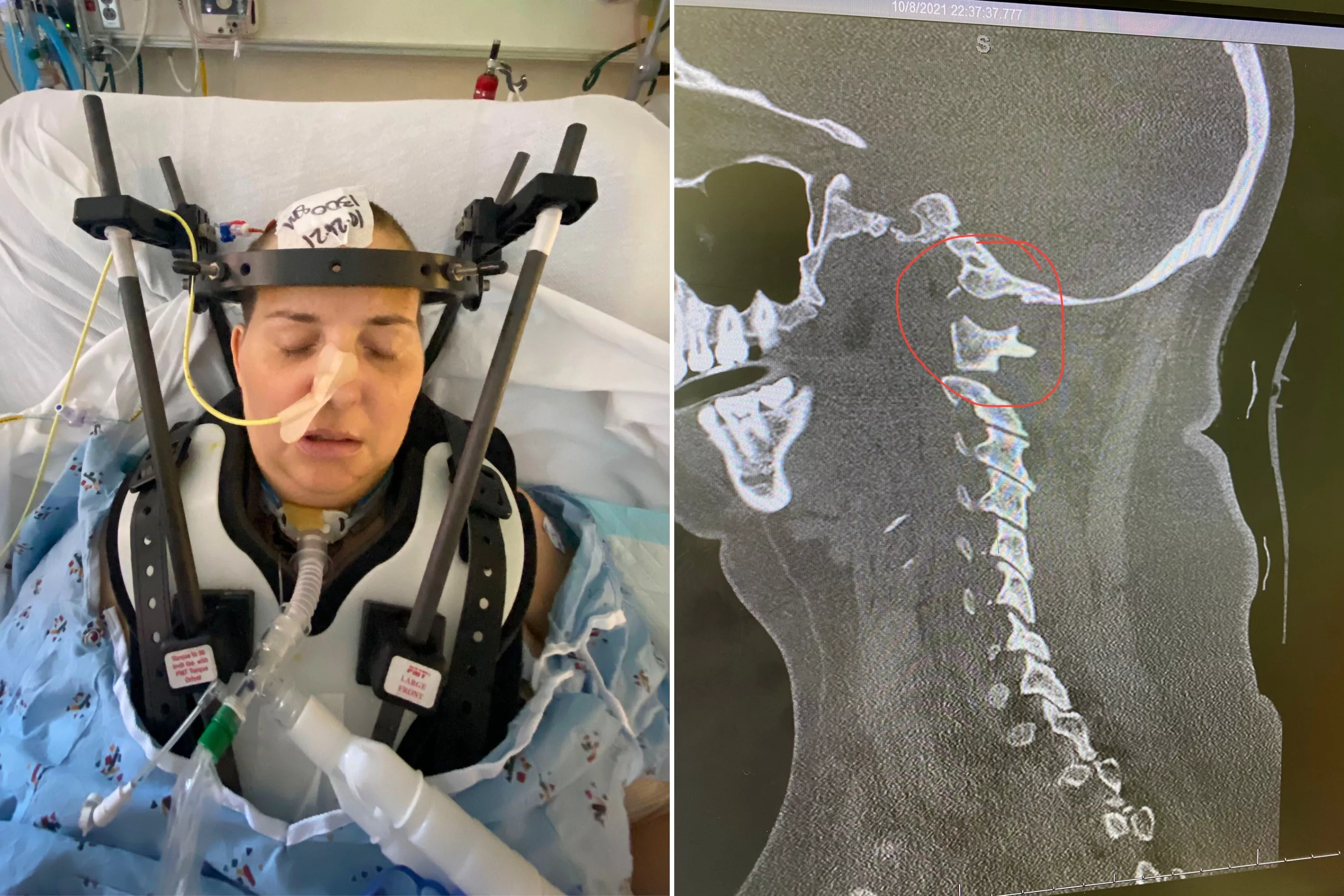 I Was Internally Decapitated. I Don't Know How I Survived - Vimarsana News