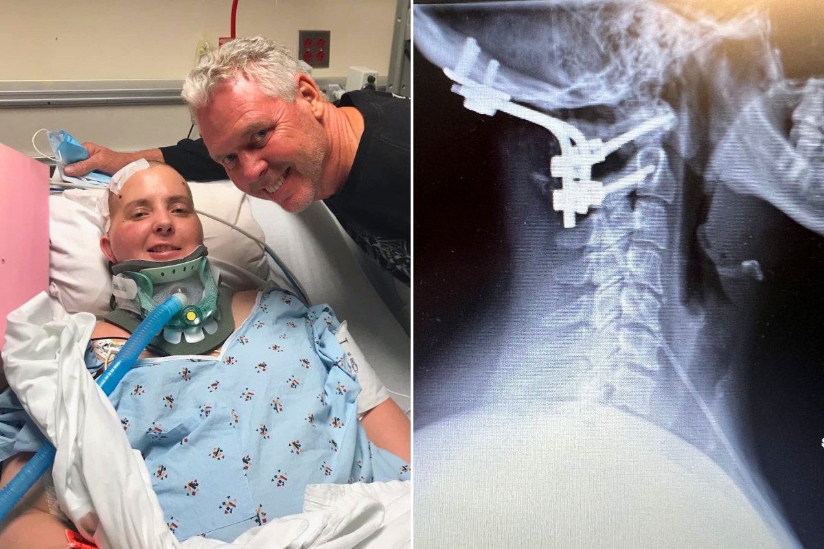 Christy Bullock ICU X ray spinal fusion