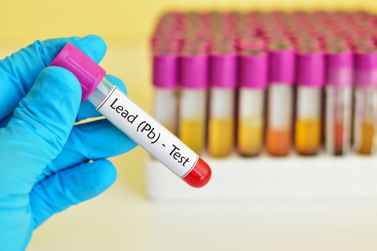 Lead test