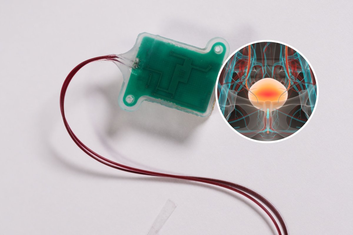 bladder sensor