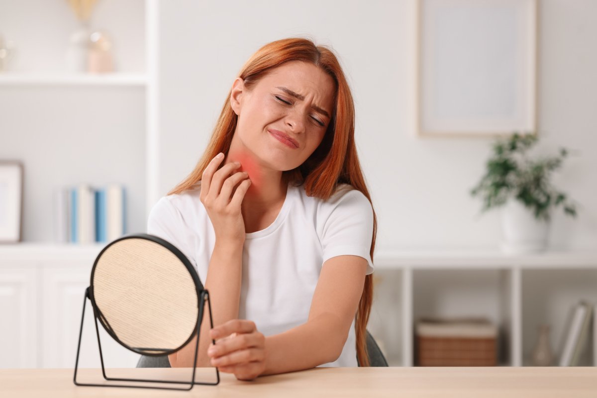Woman itching neck looking in mirror