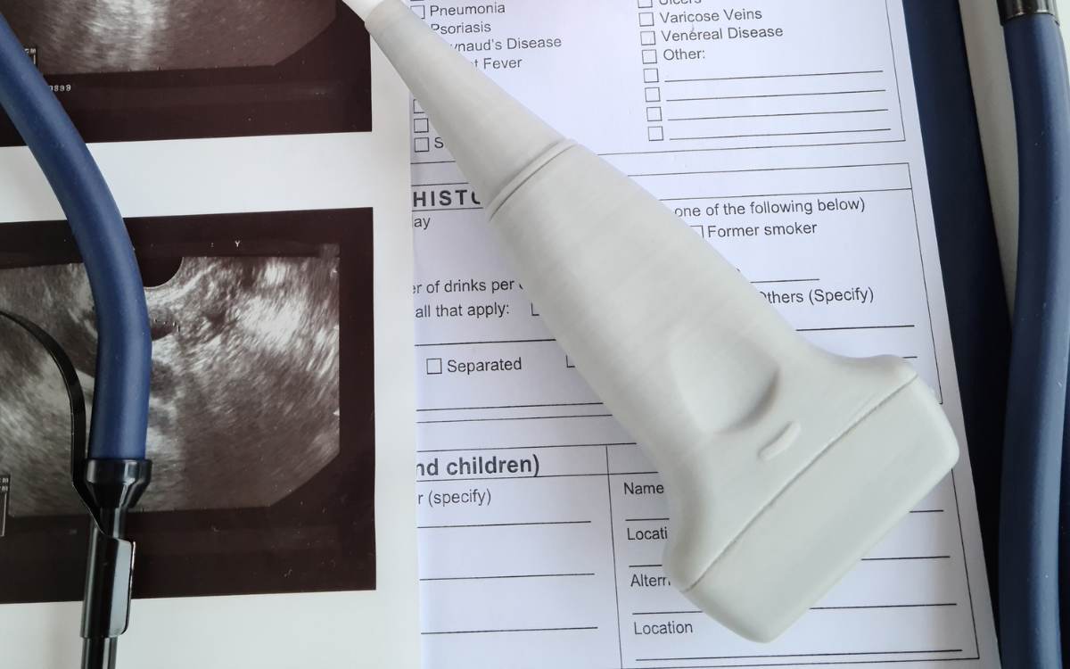 File photo of fertility equipment at hospital.