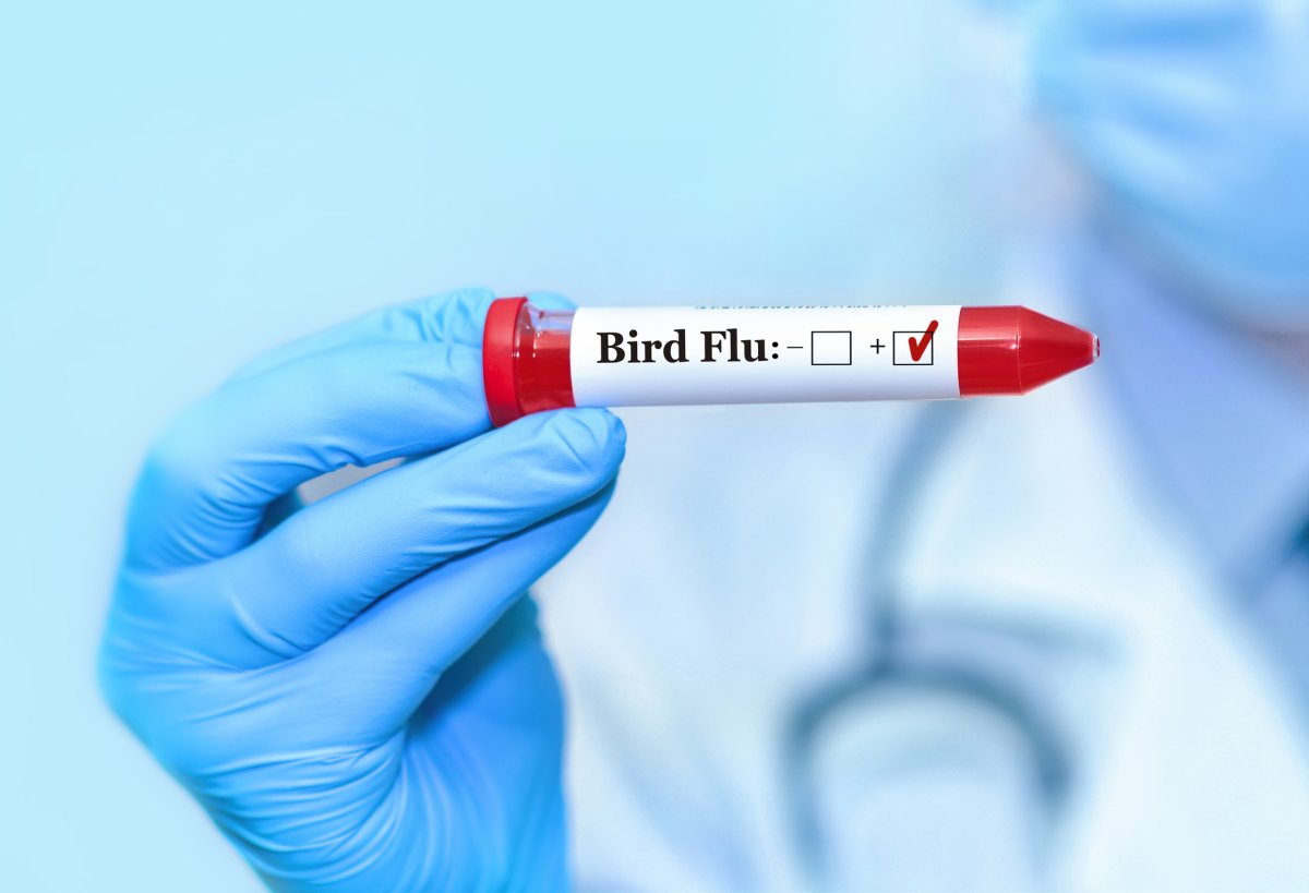 Bird flu test