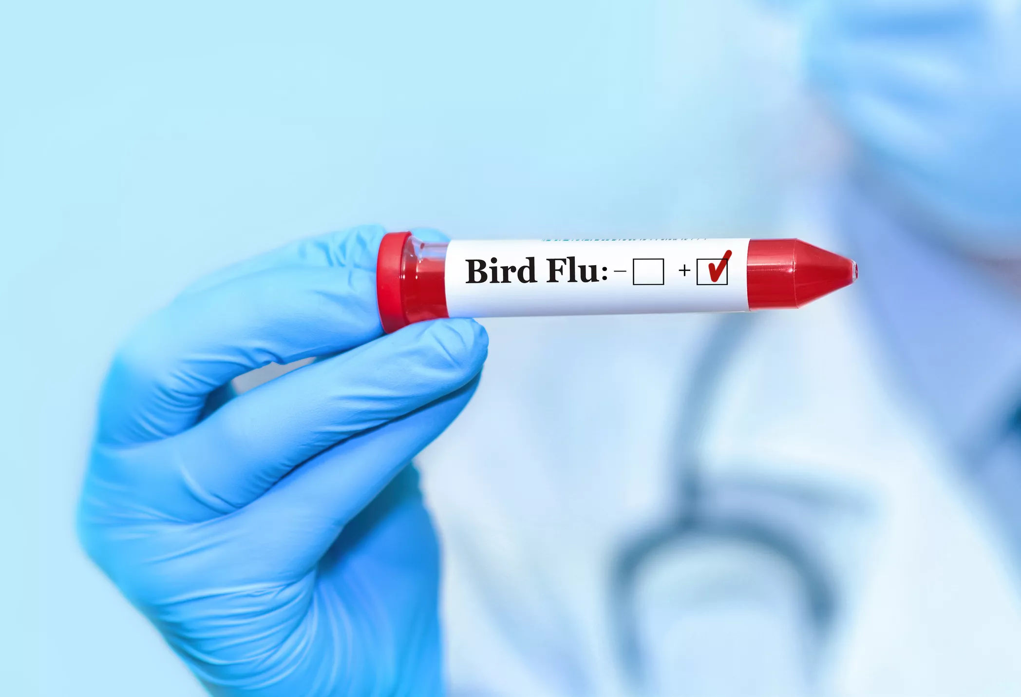 Bird Flu in US: What We Know, What We Don't - Vimarsana News