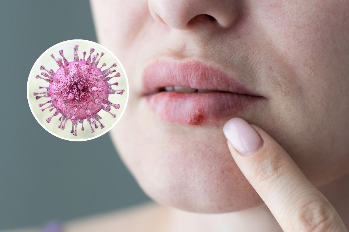 New herpes find out about unearths ‘important’ data New herpes find out about unearths ‘important’ data