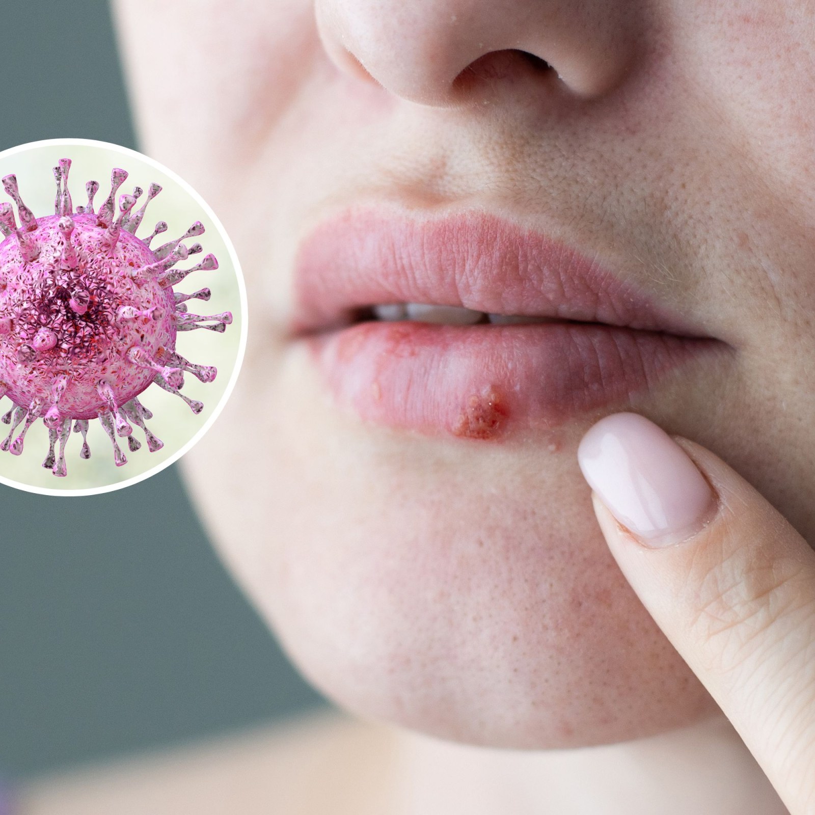 Herpes Virus Mulheres Cientistas Usam V rus Da Herpes Para Curar herpes-virus-mulheres-cientistas-usam-v-rus-da-herpes-para-curar