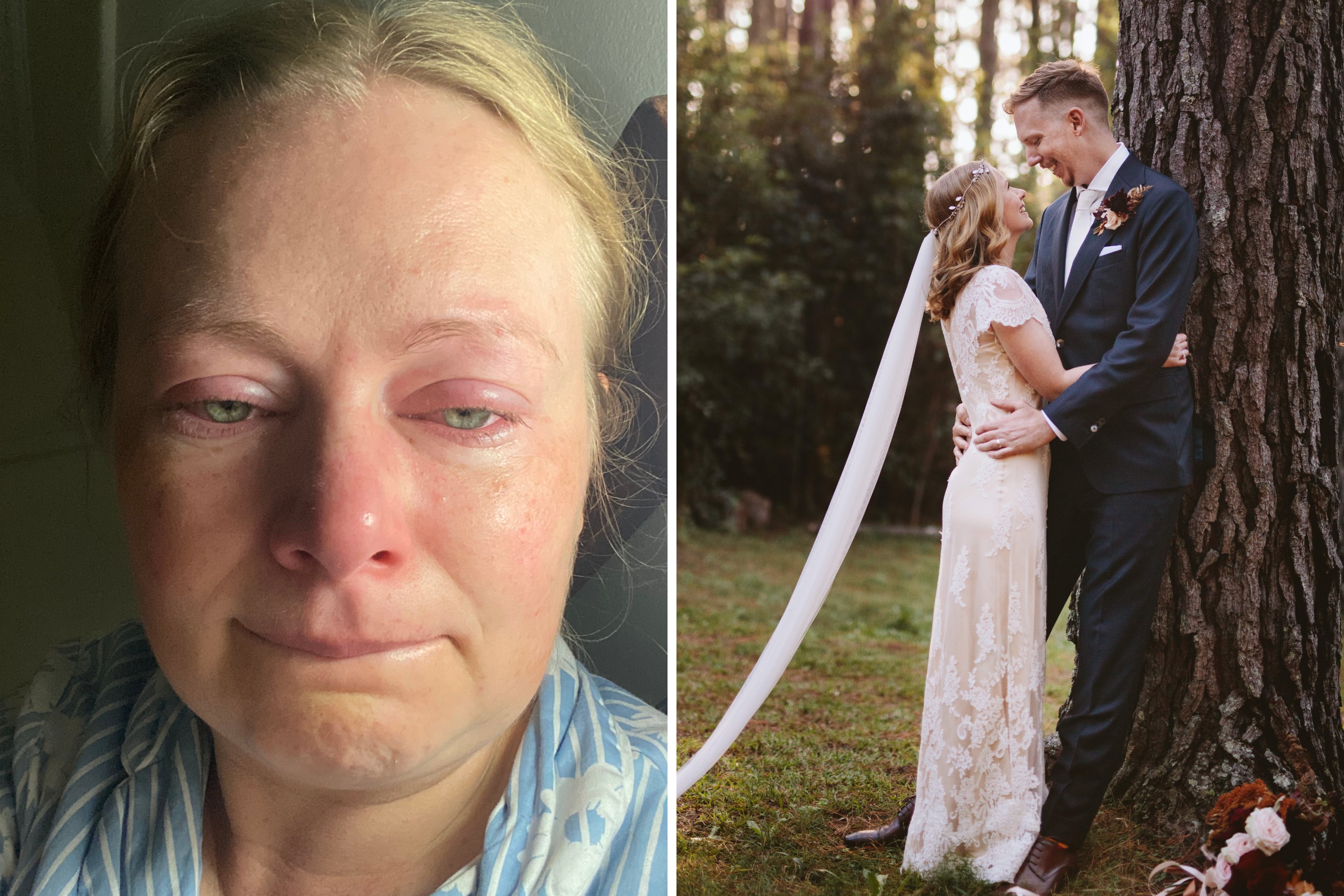 I Had Laser Eye Surgery For My Wedding Day I Wish I Knew The 