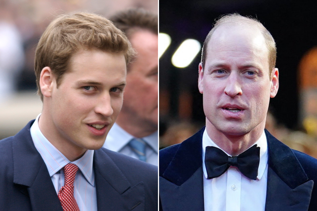 Prince William Transformation