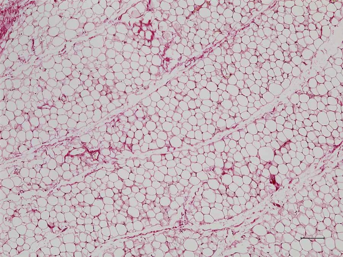Weight-loss leap forward as scientists make common fats cells burn energy Weight-loss leap forward as scientists make common fats cells burn energy