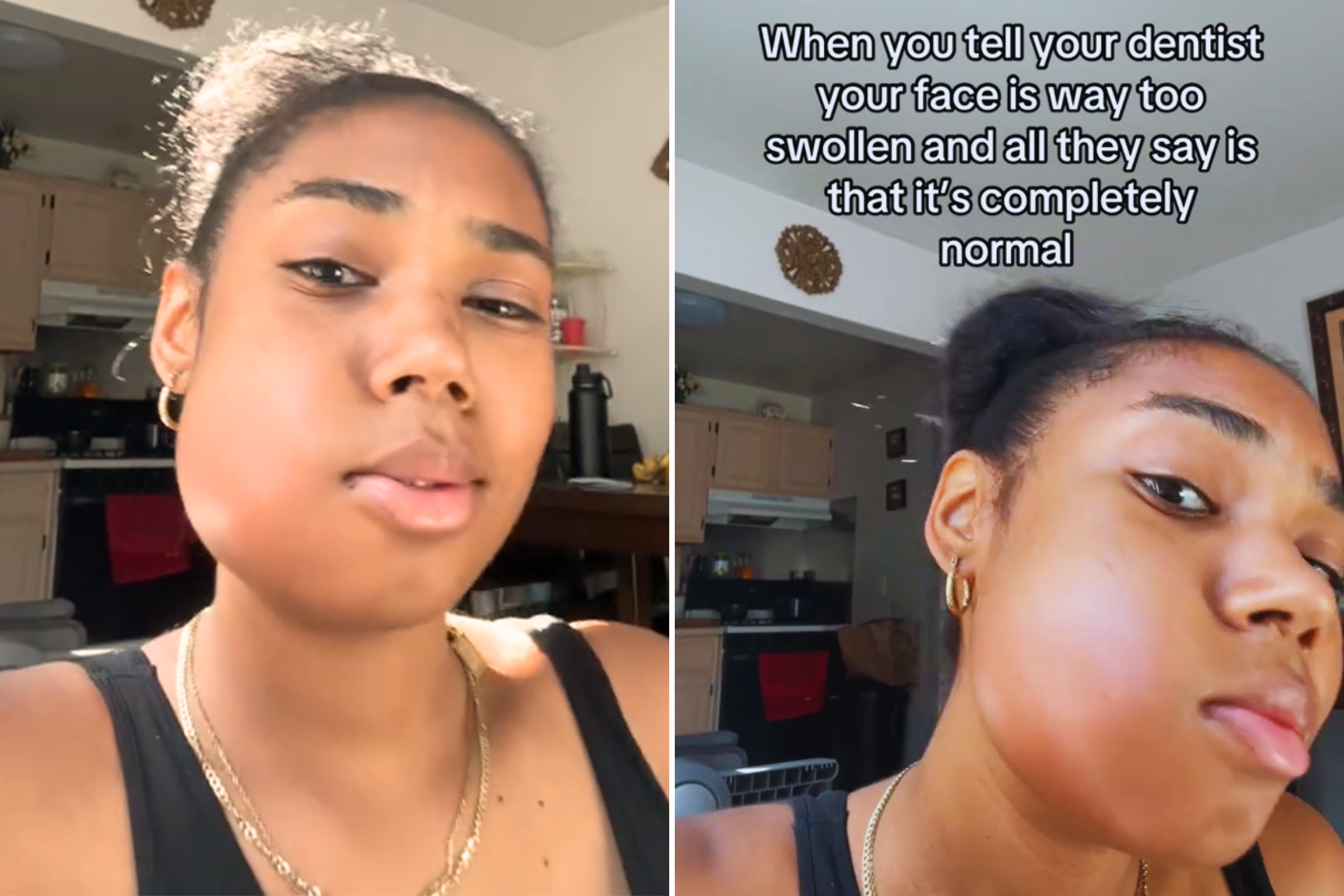 Internet Horrified by Woman&rsquo;s Shocking Reaction After Wisdom Teeth 