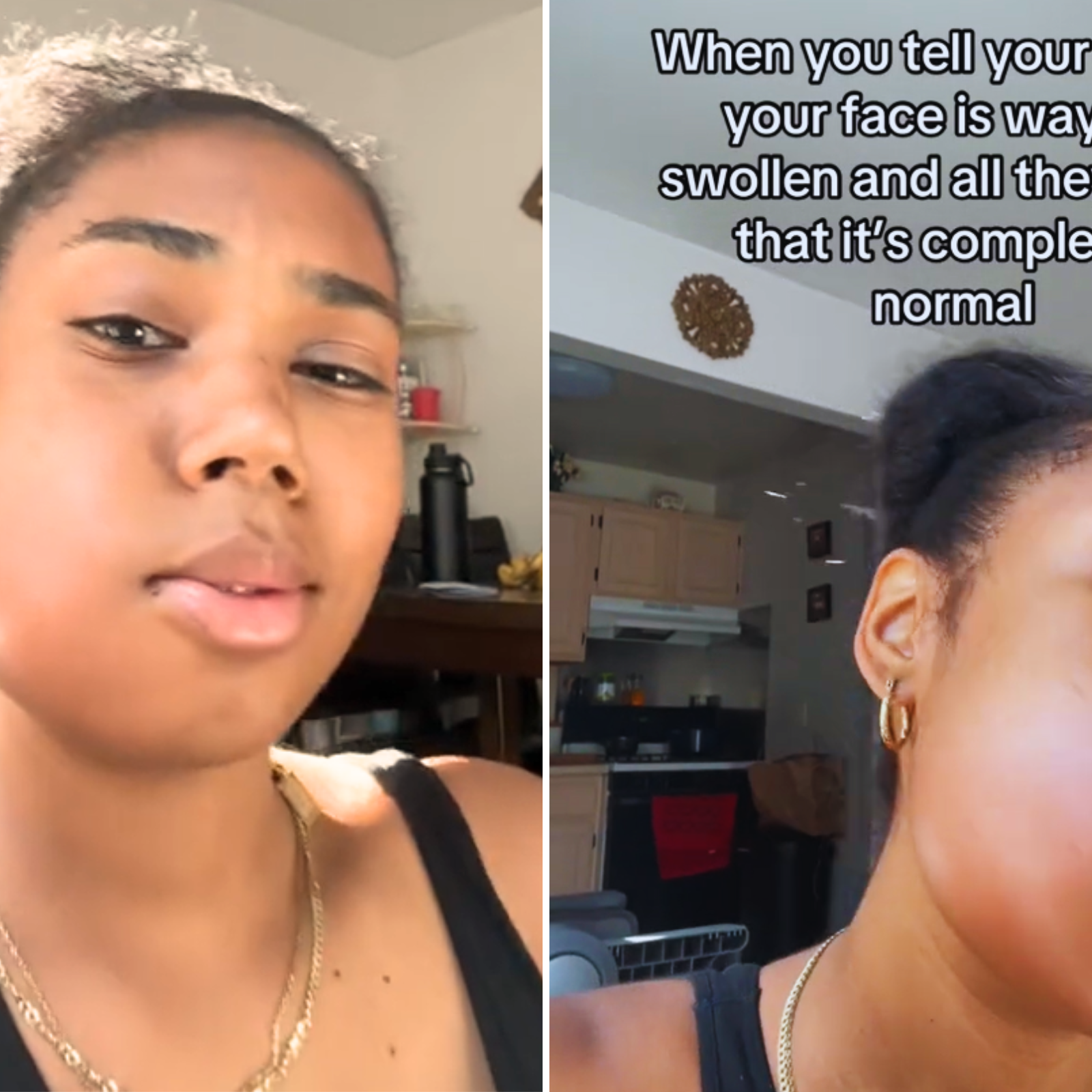 Internet Horrified by Woman’s Shocking Reaction After Wisdom Teeth