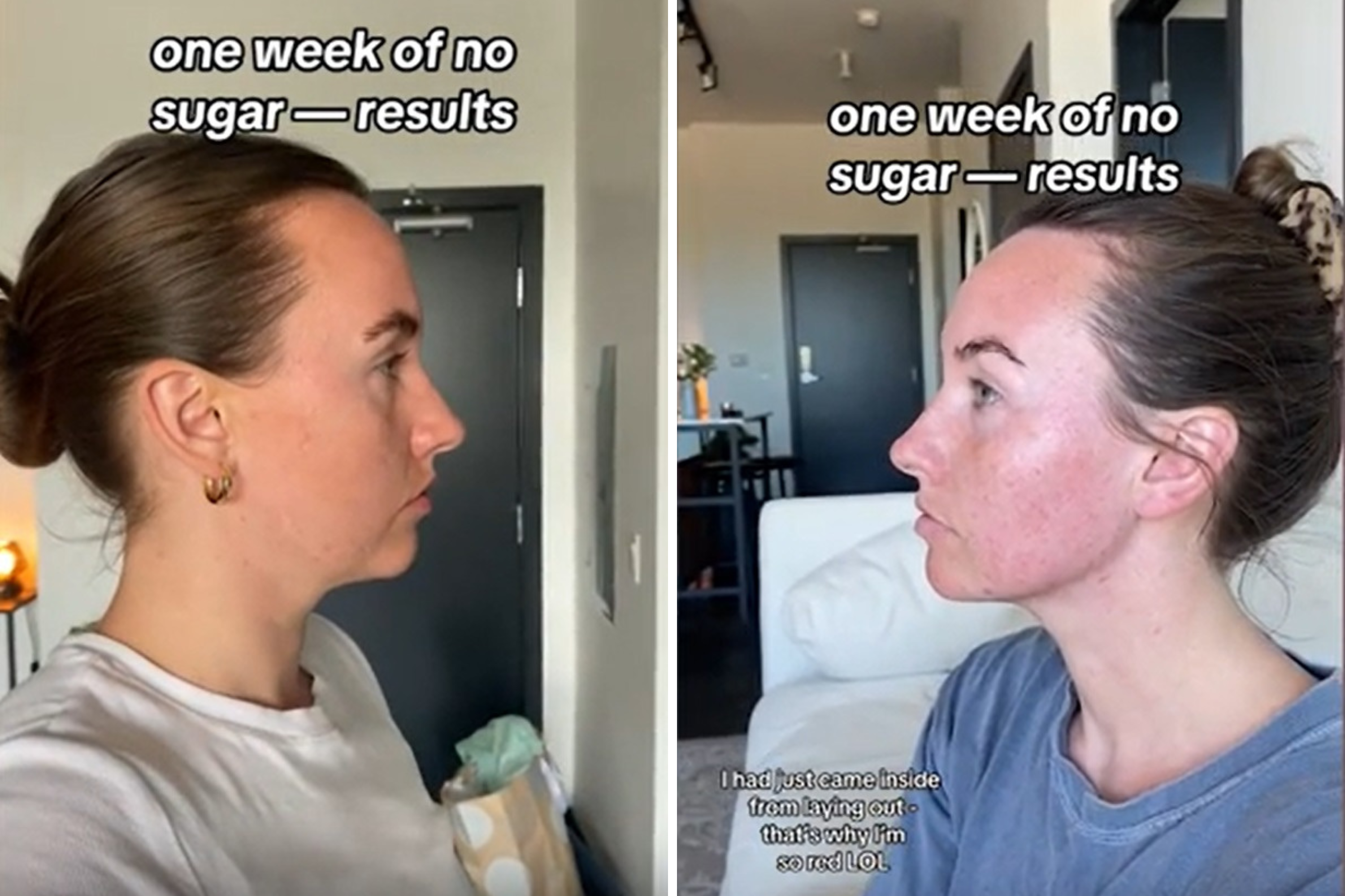 Woman shares how her jawline reappeared after just 