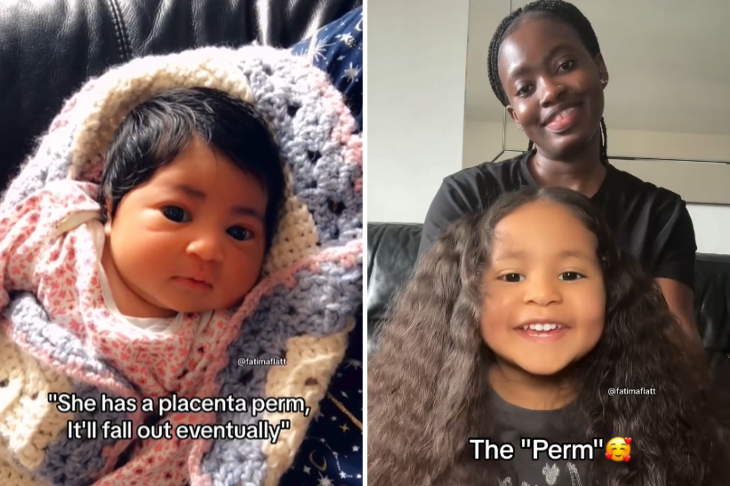 Internet Goes Wild Over Baby Girl with ‘Placenta Perm’ Hairstyle