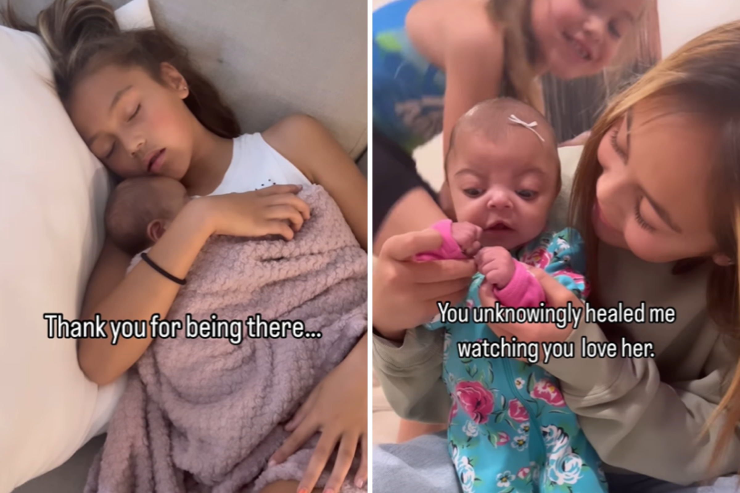 Little Girl Caring For Newborn Sister With Rare Condition Breaks Hearts