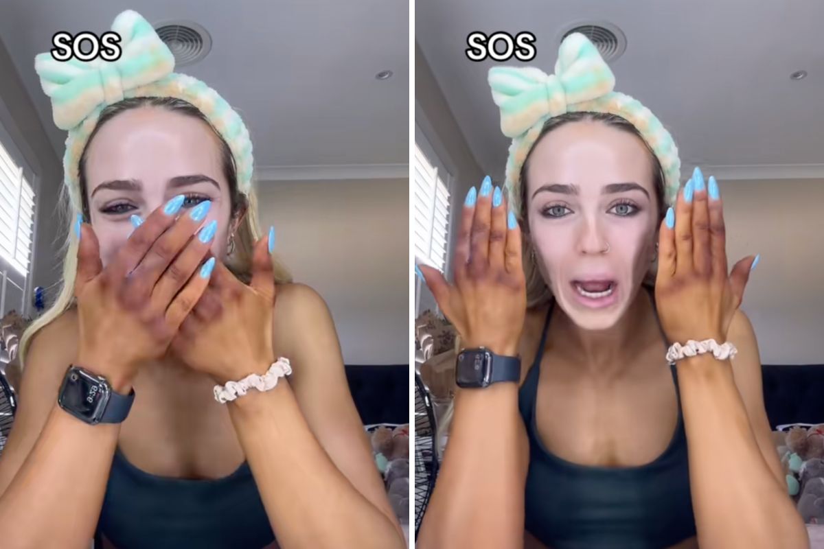 Amy Nelson's tanning blunder.