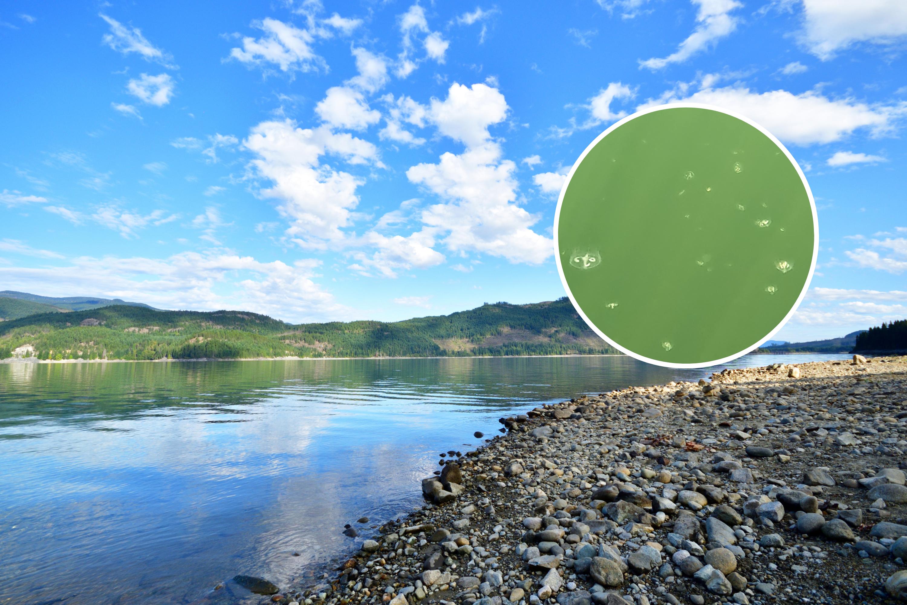 Lake in British Columbia and jellyfish