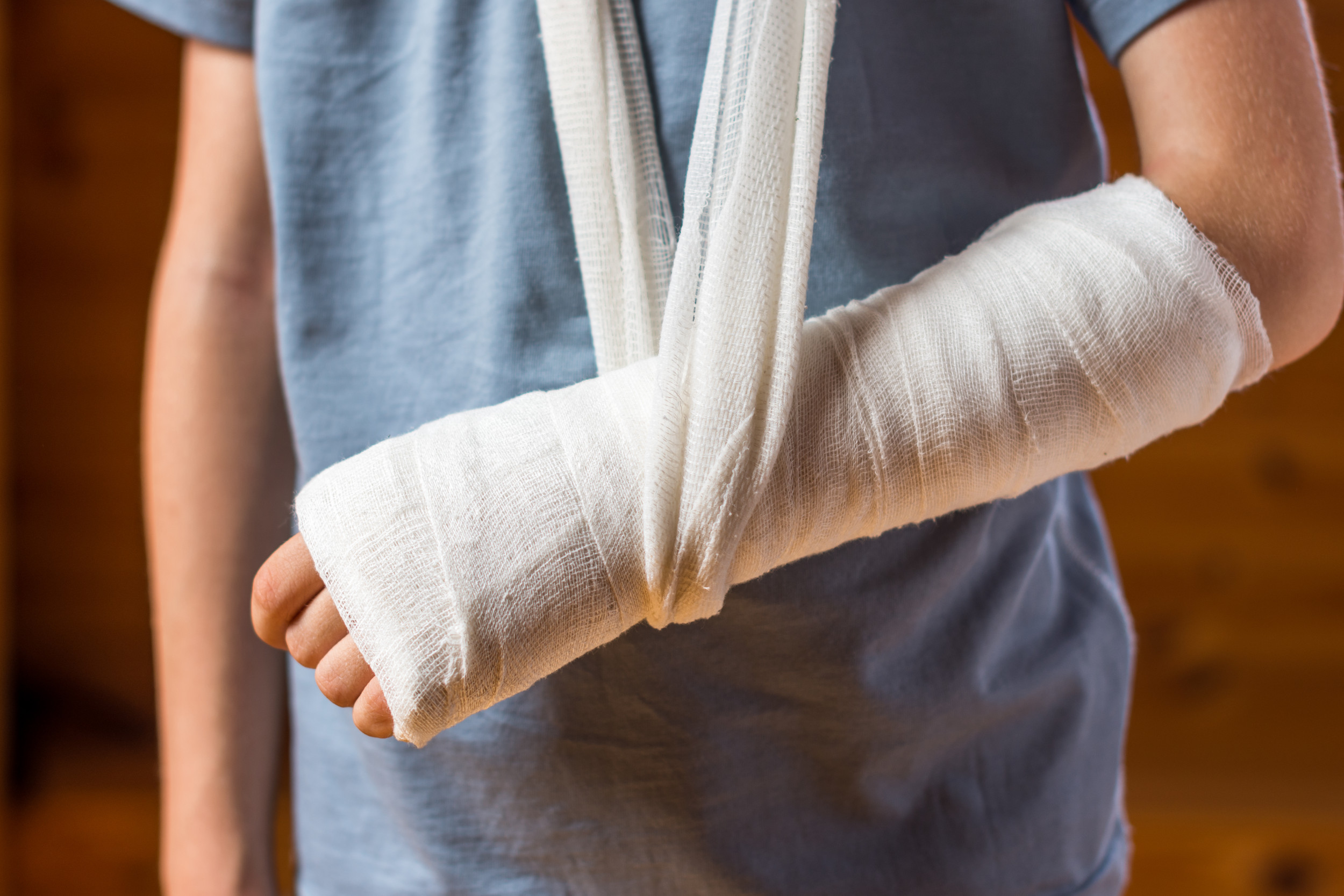 Bone Is Broken