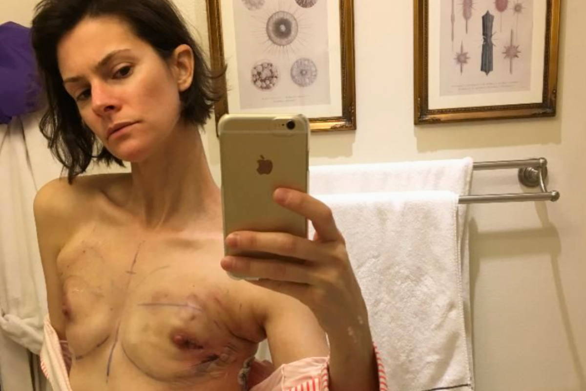 Devin Sidell double mastectomy