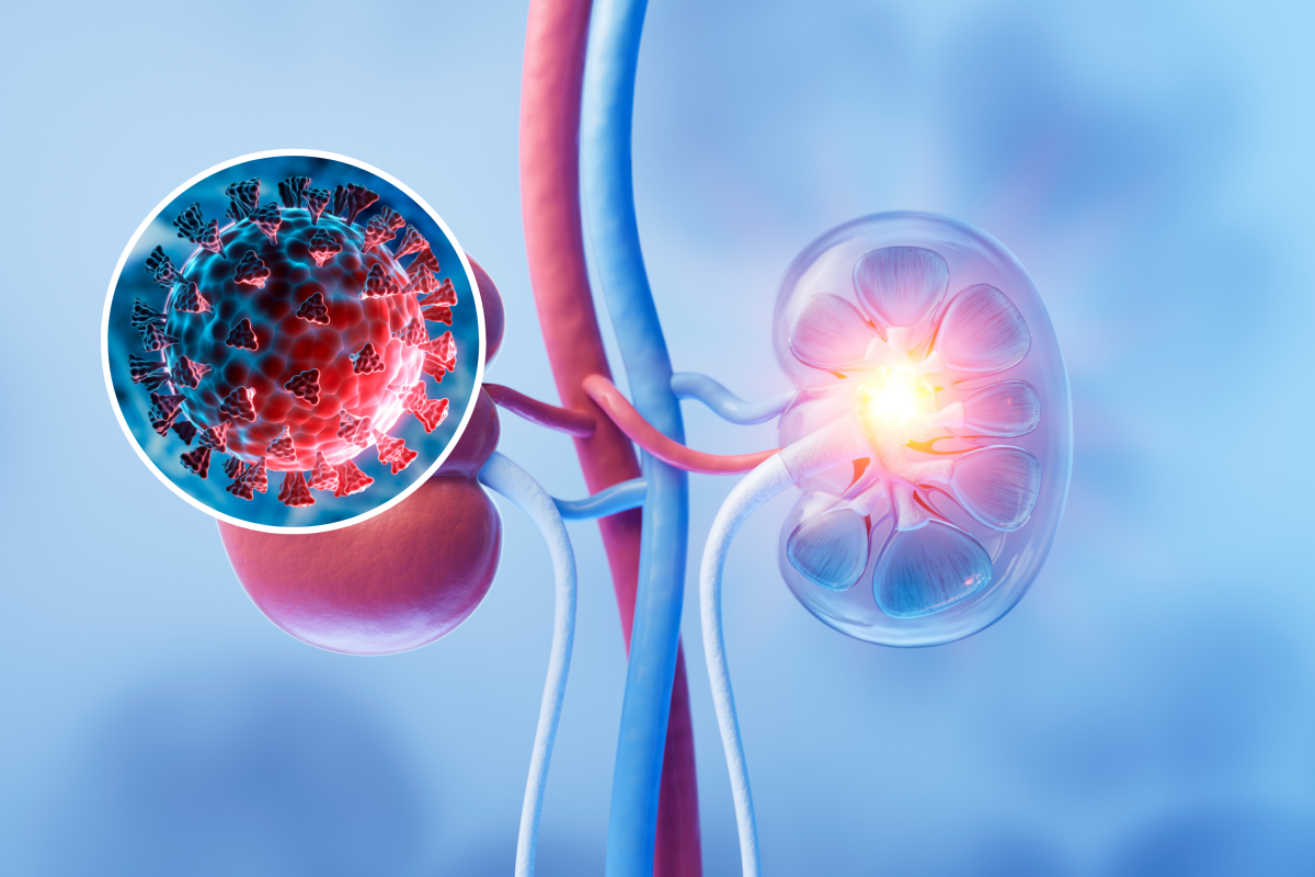 COVID May Increase Risk of Kidney Disease