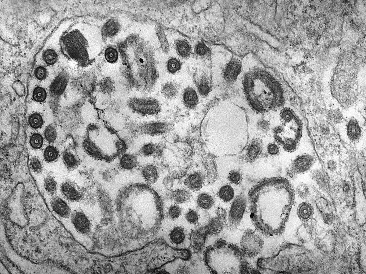 TEM of the Marburg virus