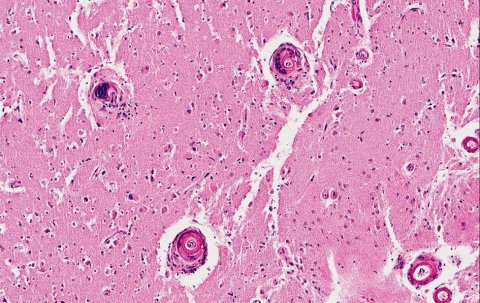 5.2_NW0418_BrainLabs_05 5.2_NW0418_BrainLabs_05