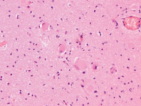 5.2_NW0418_BrainLabs_06 5.2_NW0418_BrainLabs_06