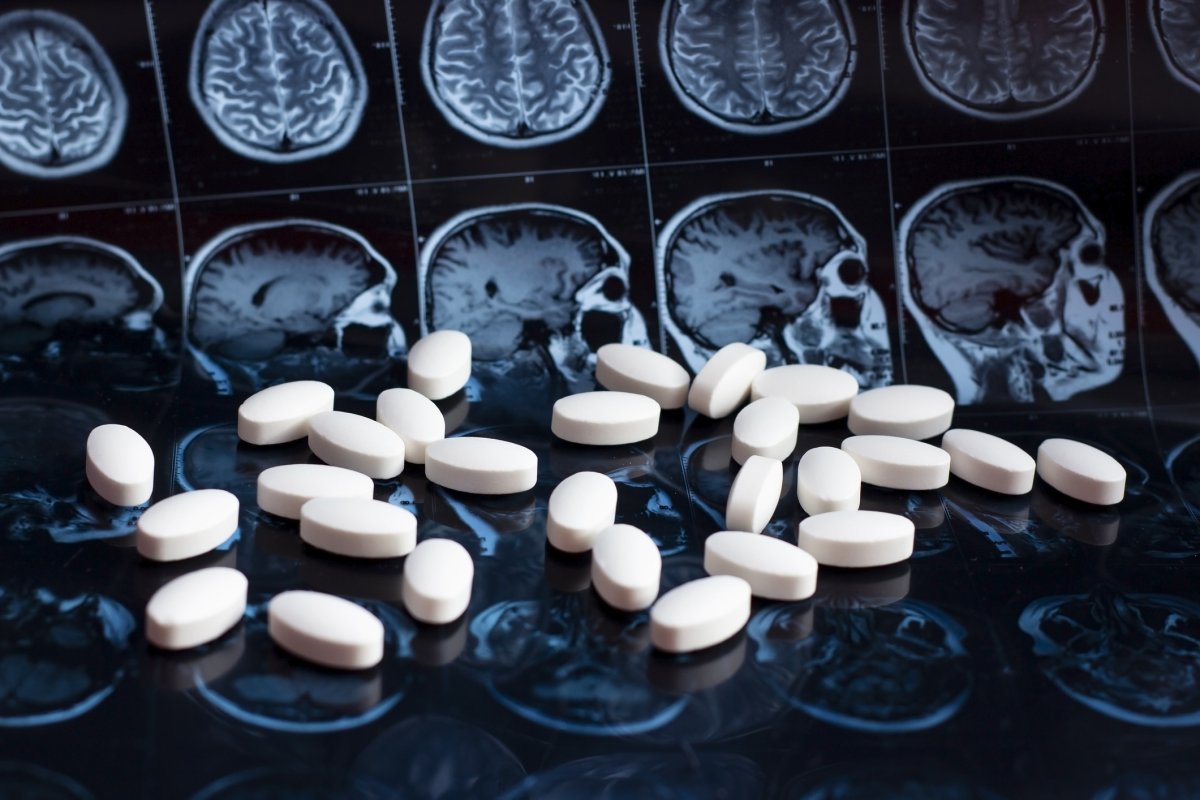 Alzheimer’s: Easy drug alternate may just save Medicare loads of thousands and thousands