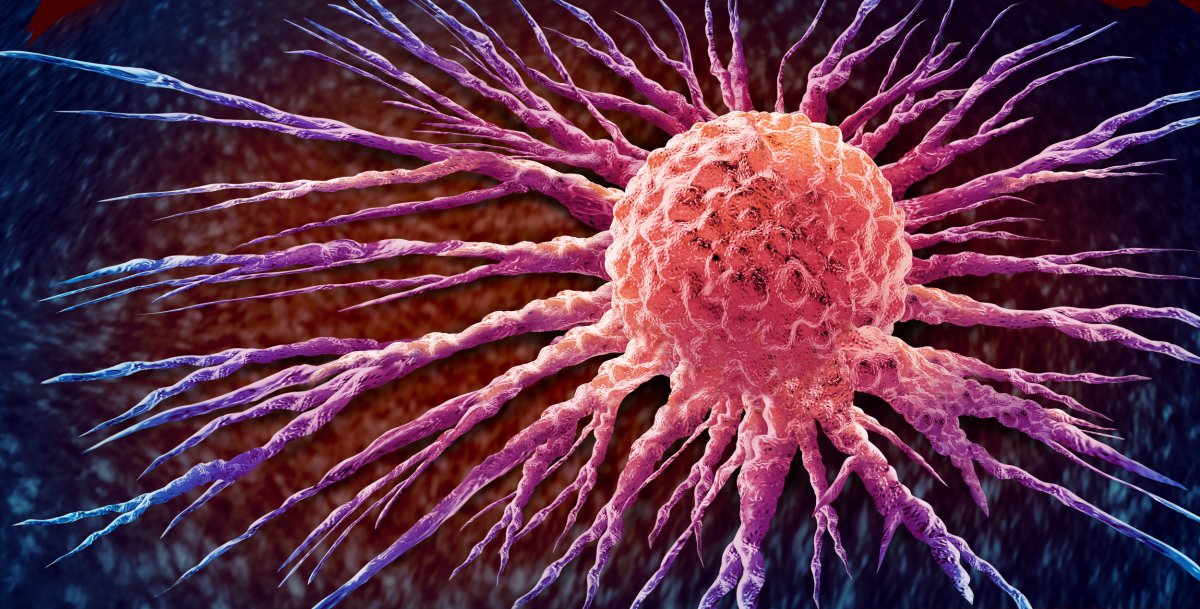 An artist's impression of a cancer cell