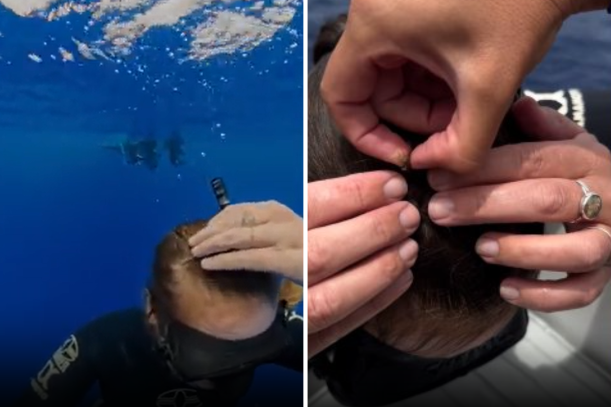 A woman finds crab in her hair.