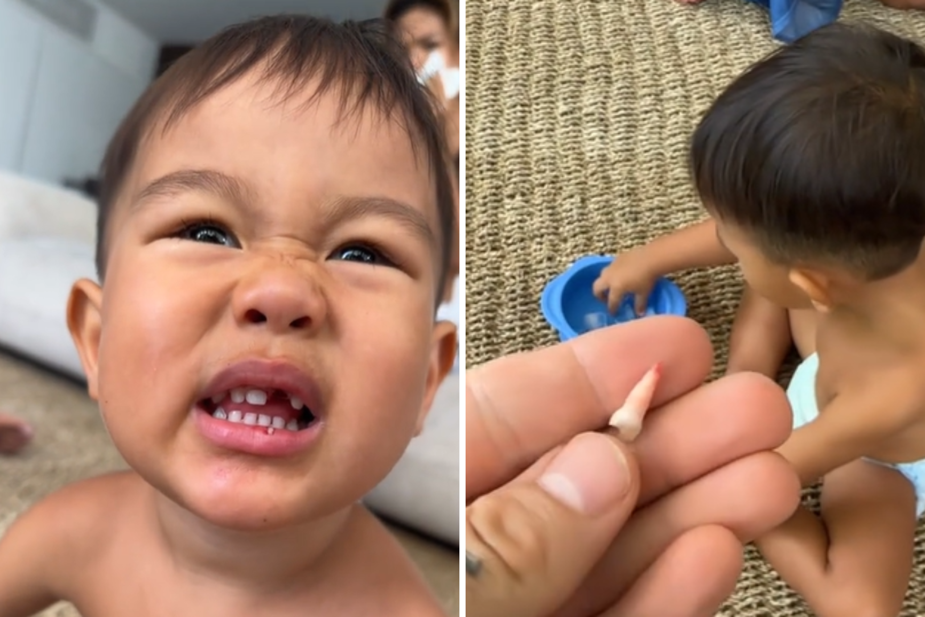 Dad horrified as two-year-old son accidentally rips his own tooth out—"why"