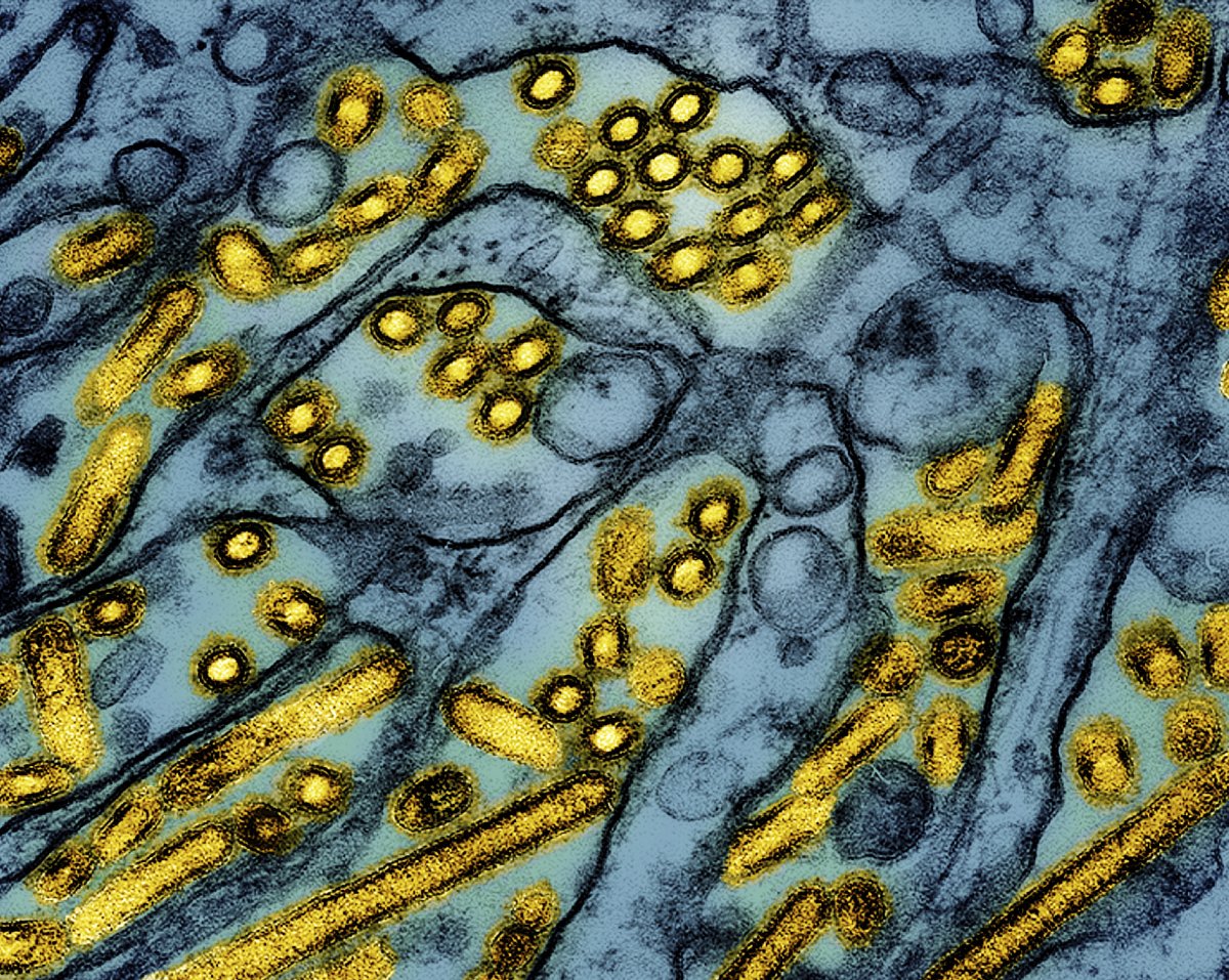 Bird flu particles seen under microscope