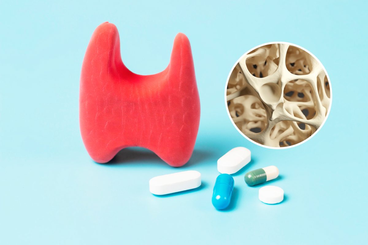 Thyroid model and pills, osteoporosis