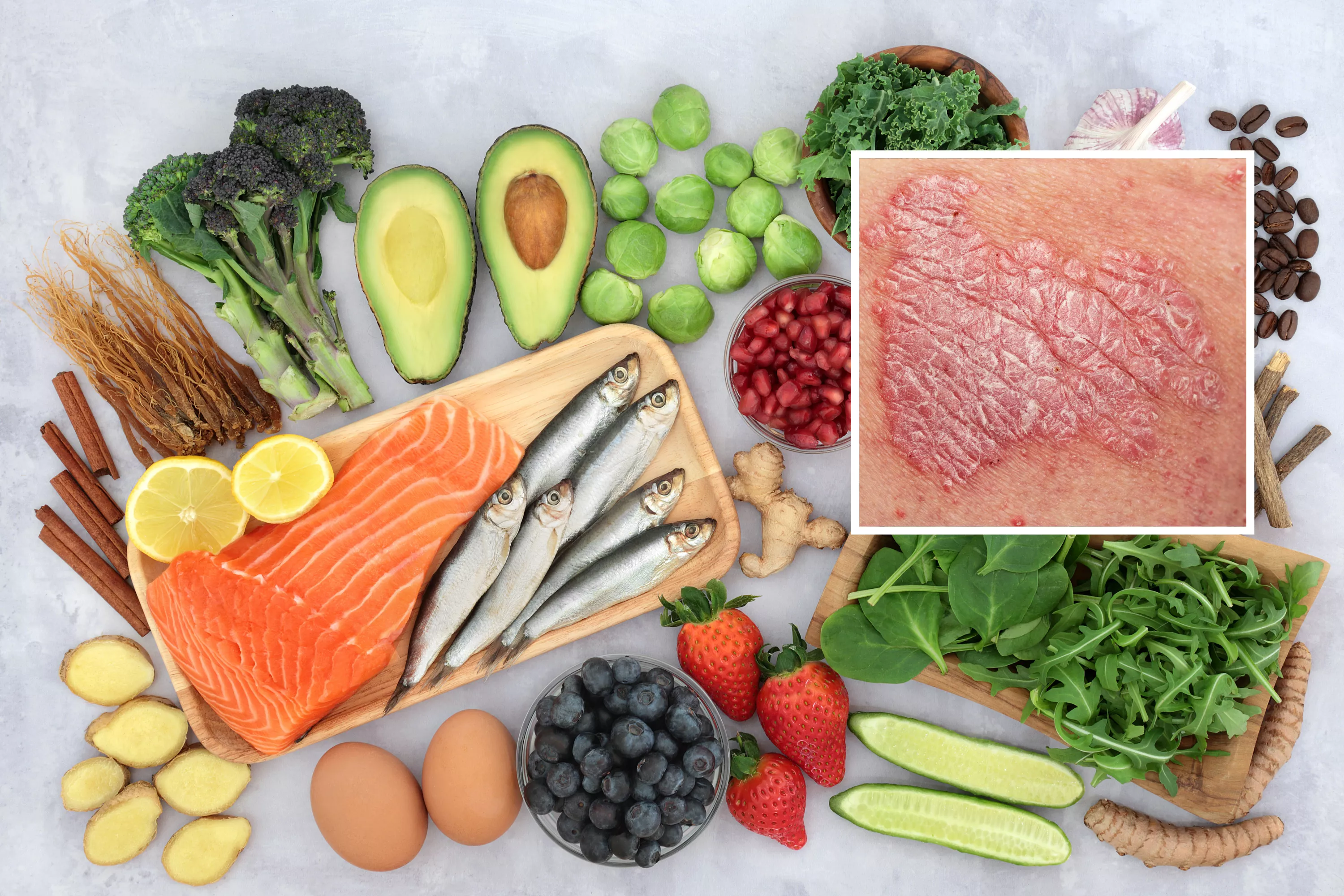 Nutritionist tackled common skin condition with diet change
