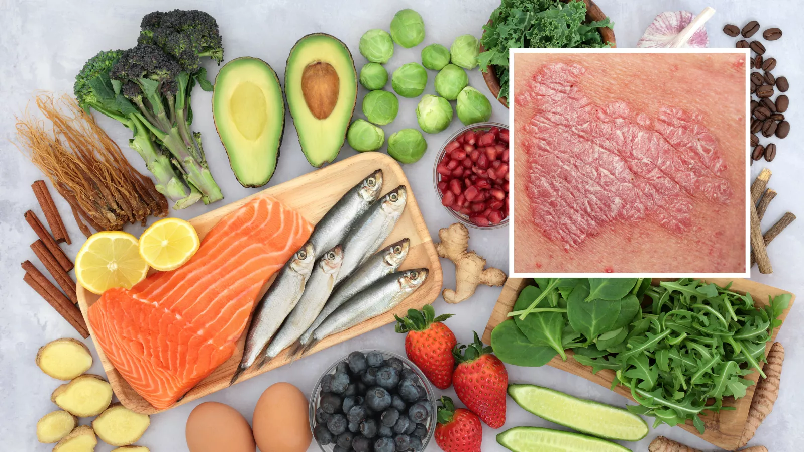 Nutritionist tackled common skin condition with diet change