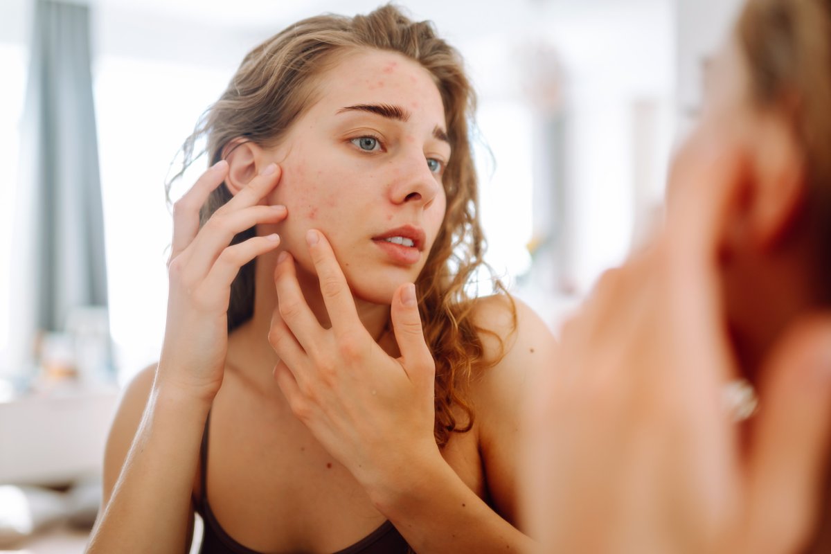 Woman checking her skin