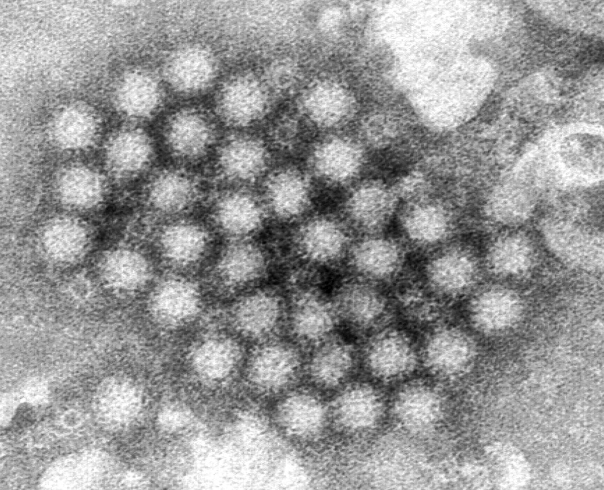 Norovirus 