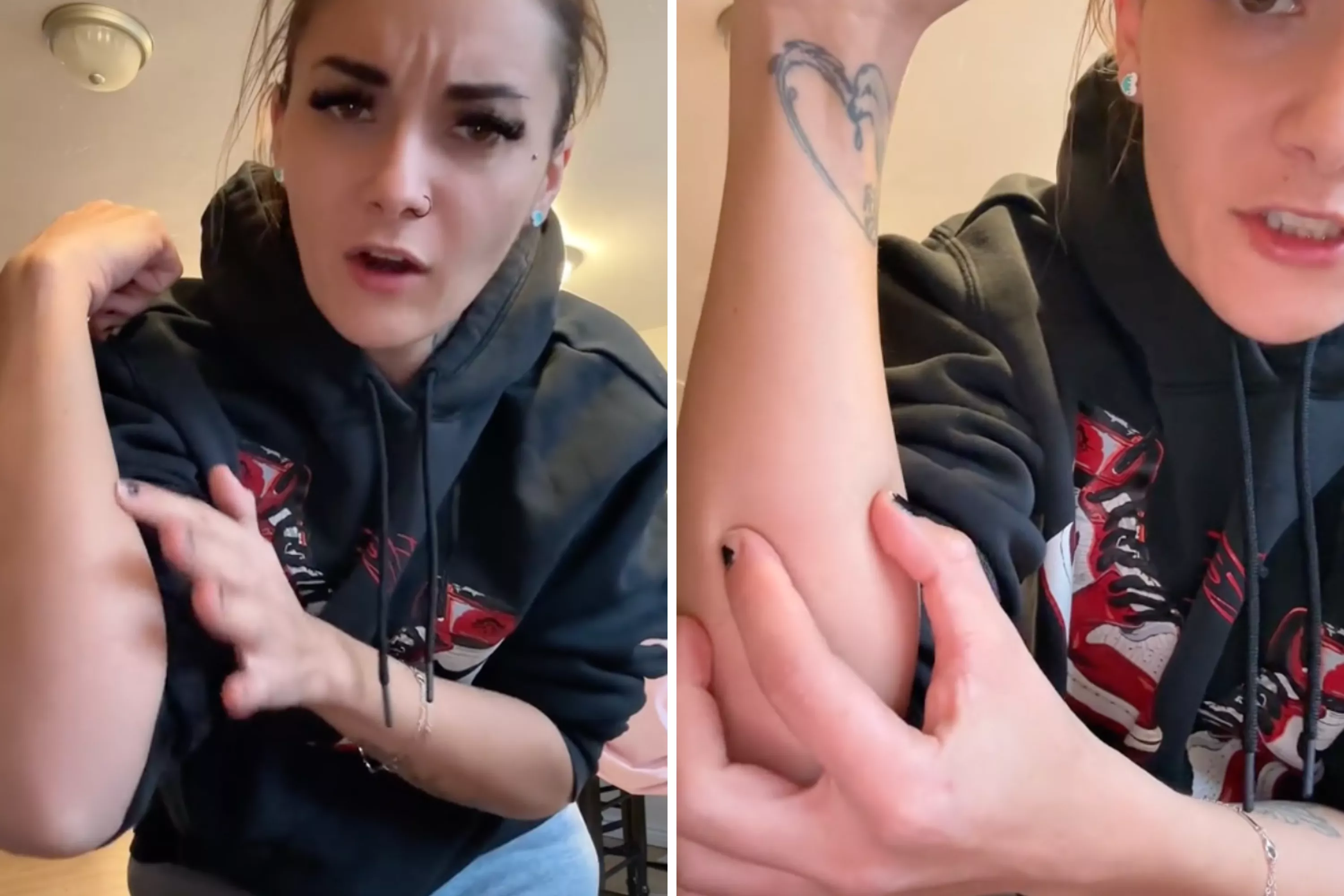 Woman discovers foreign object inside her arm, asks internet for help