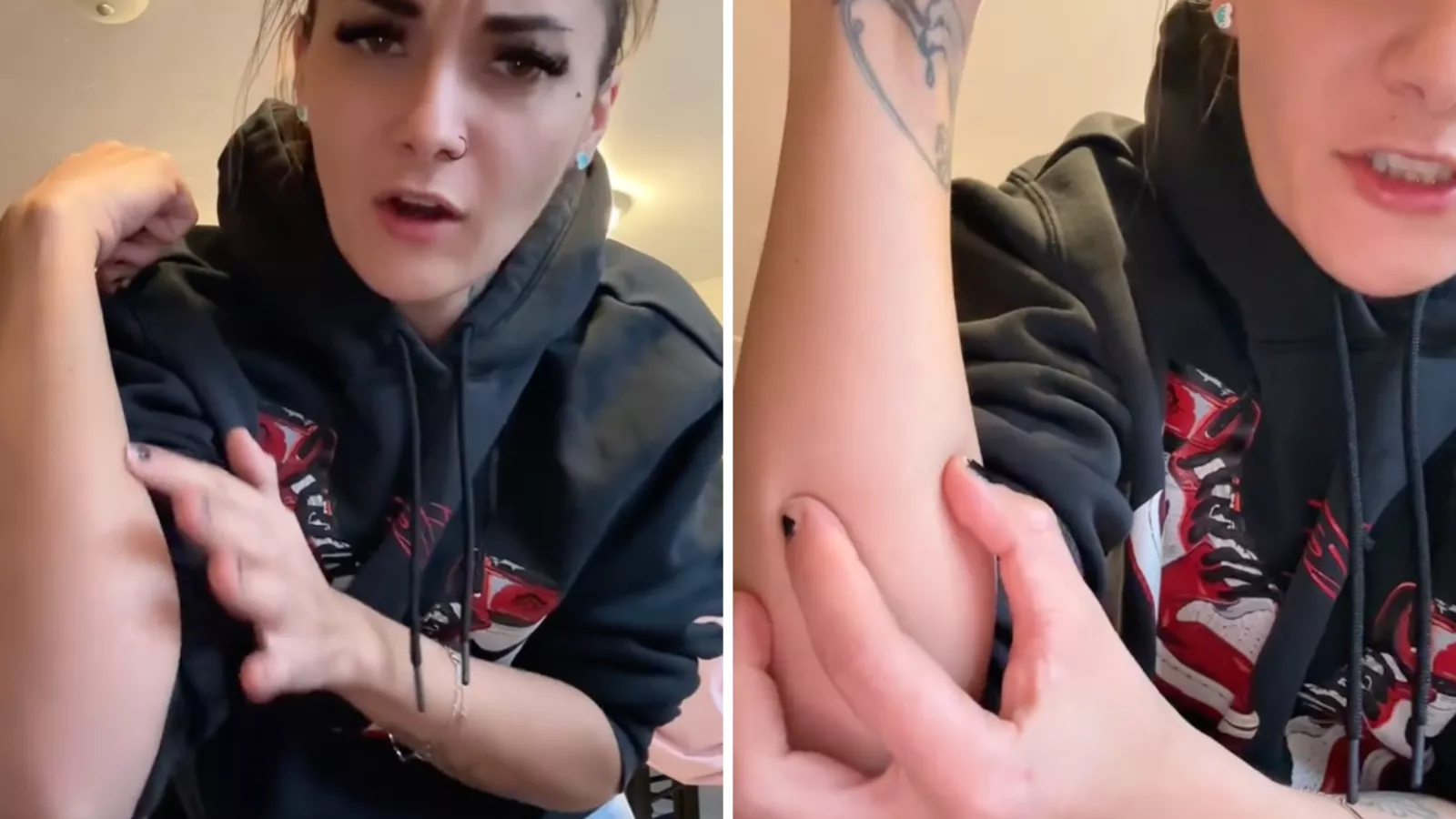 Woman discovers foreign object inside her arm, asks internet for help