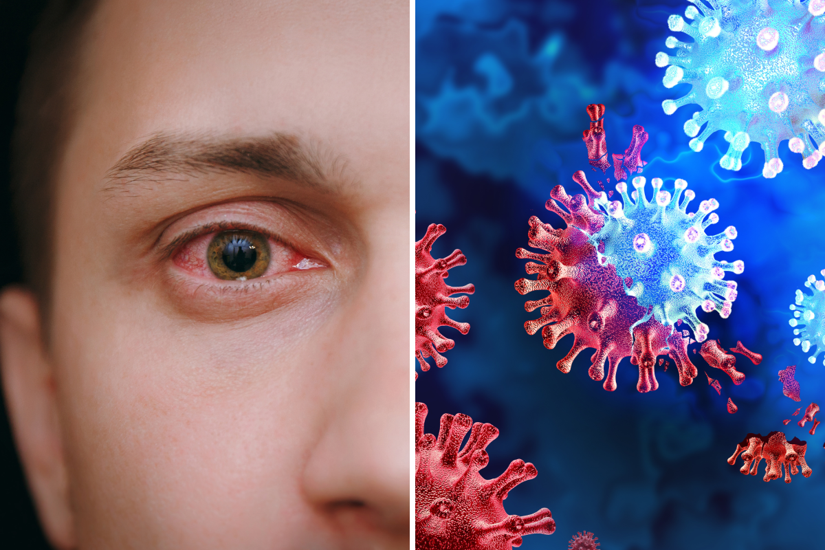 Pink eye and virus mutation