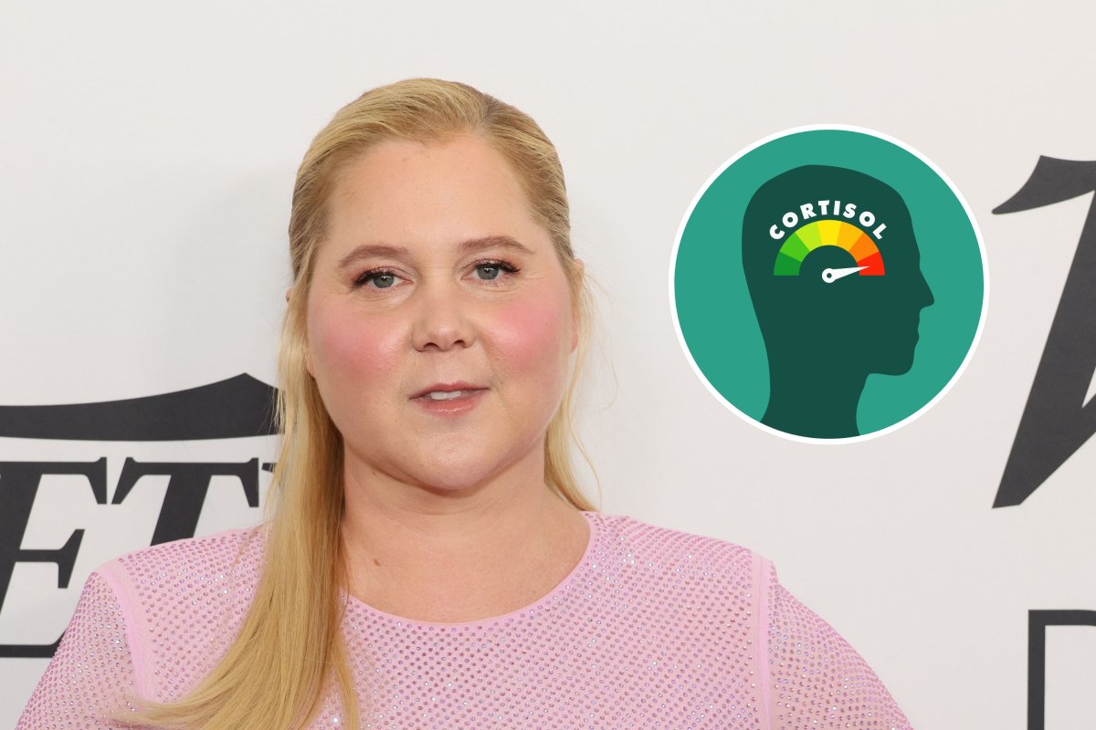 amy schumer cushing's syndrome