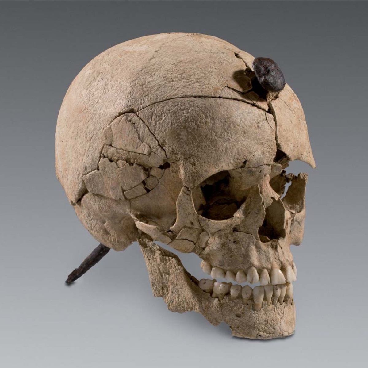 Archaeologists Reveal Secrets of Chilling Iron Age Nailed Head Ritual