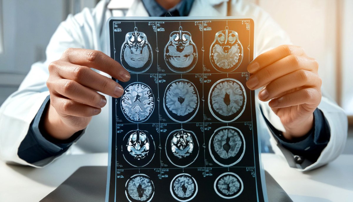 Medic Holds Up MRI Scan Brain