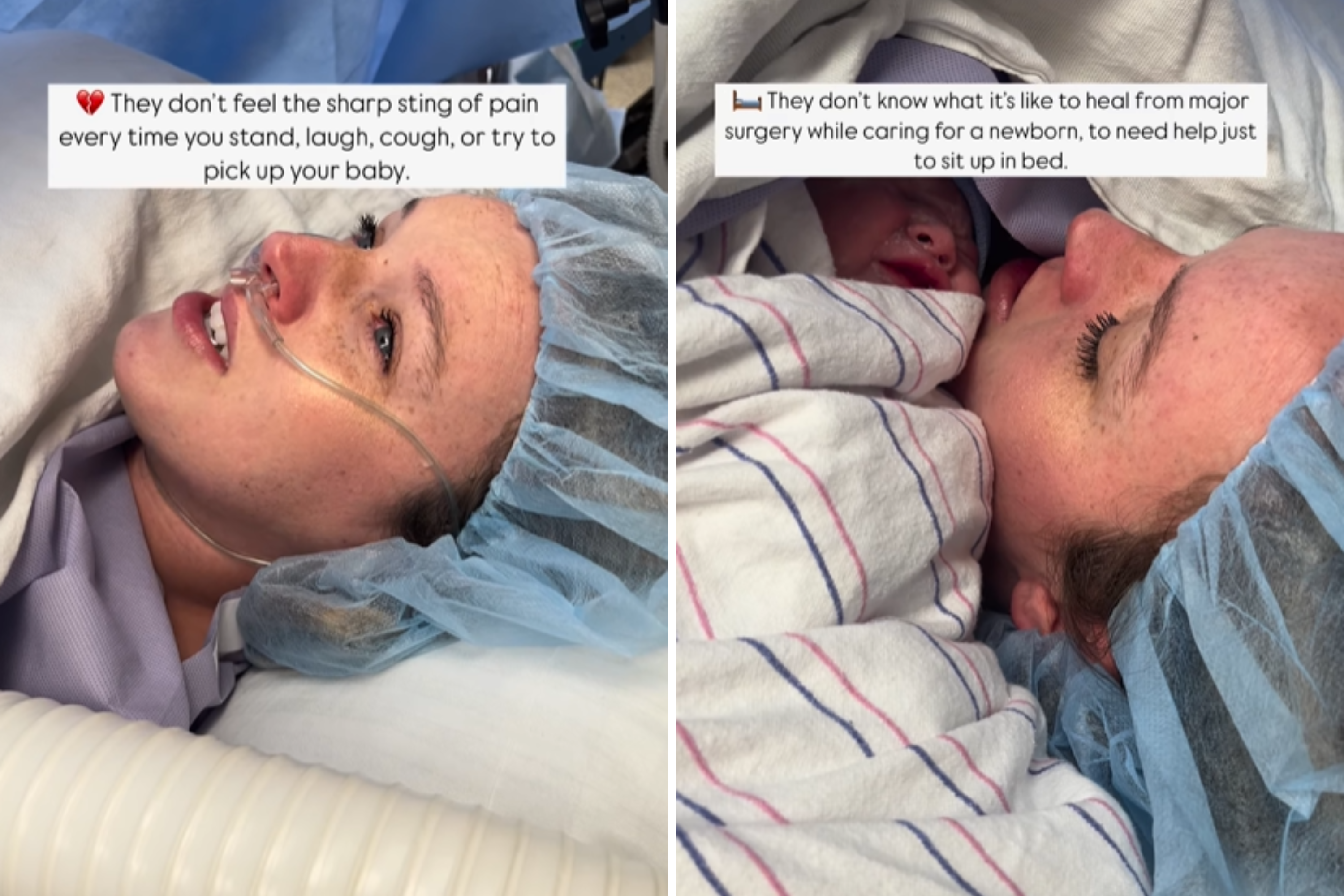 Mom-of-two's important message on why C-sections are never 'easy way out'