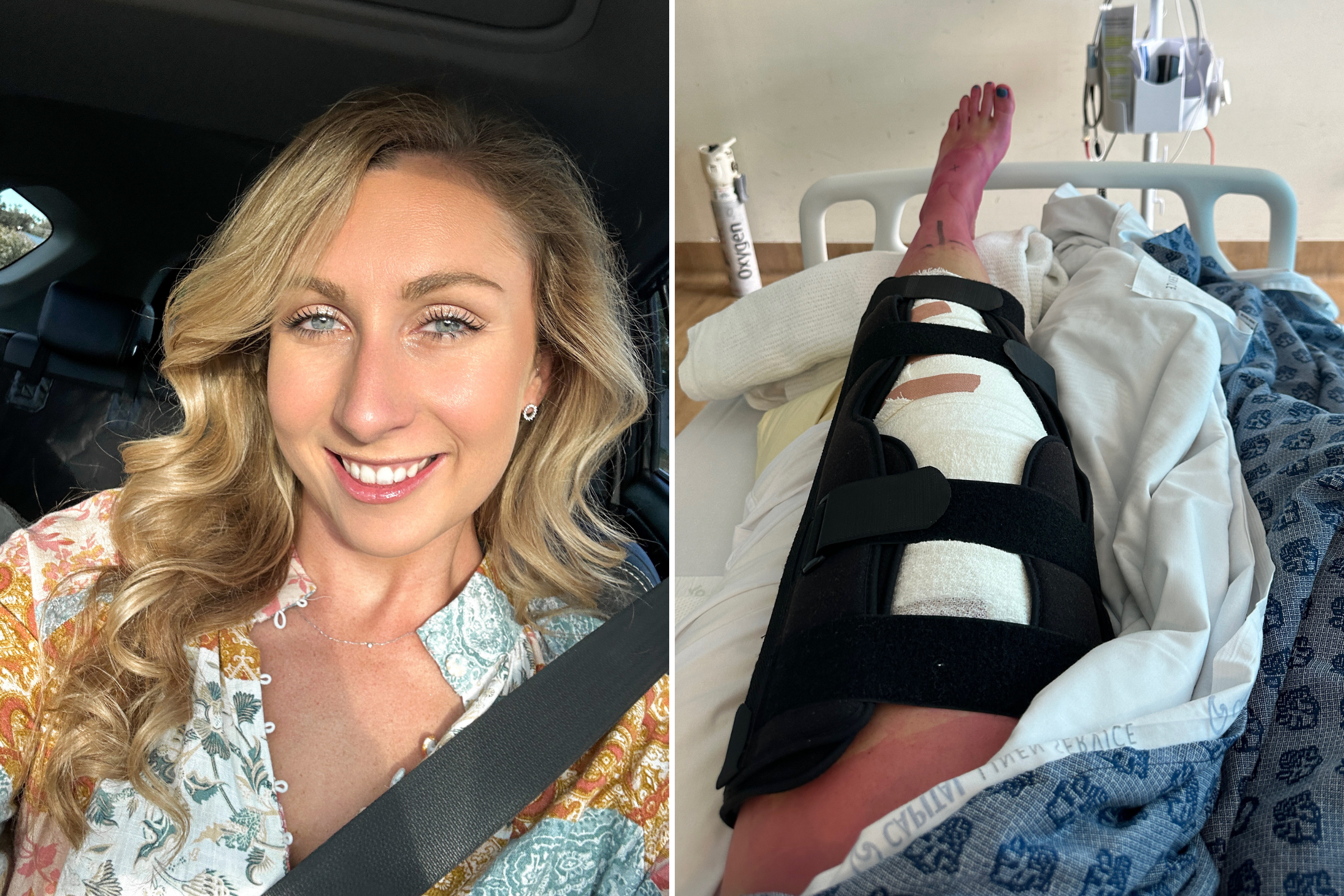 Woman Challenges Friends to a Race, Ends Up in Hospital Needing Surgery