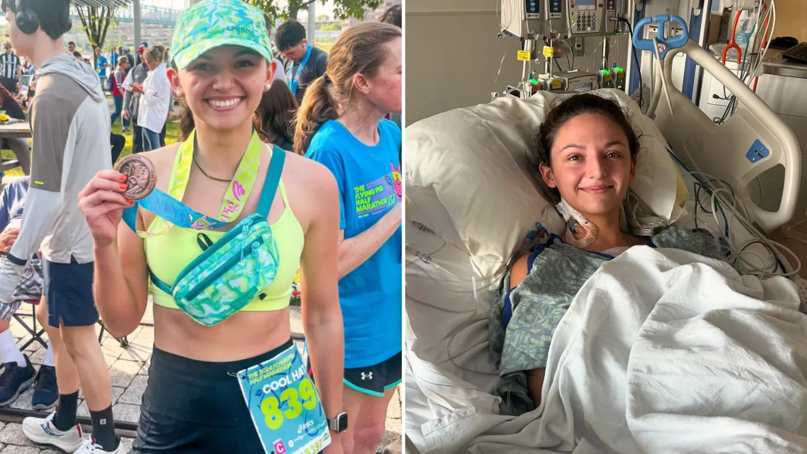 Marathon runner who felt breathless finds out she has heart failure at 24