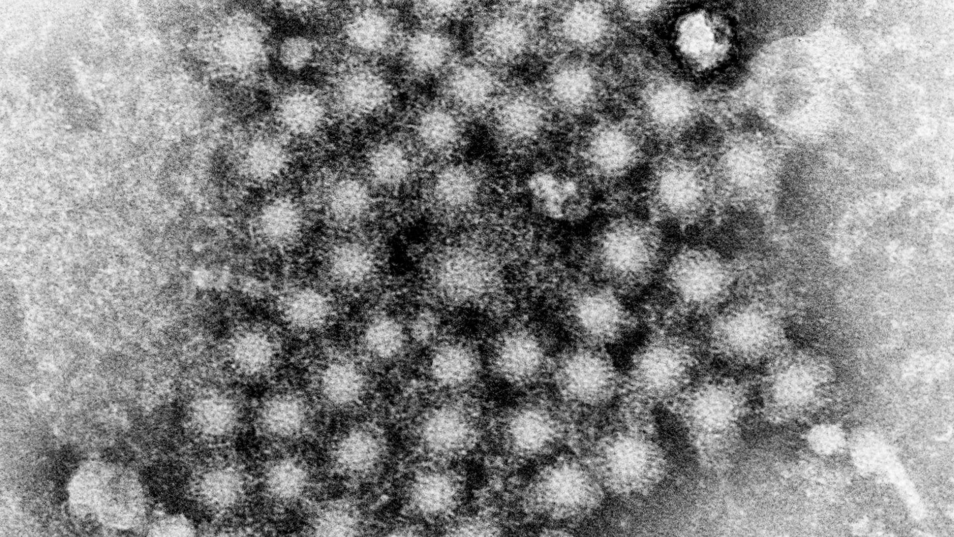 Hepatitis A Outbreak in Los Angeles: Everything We Know