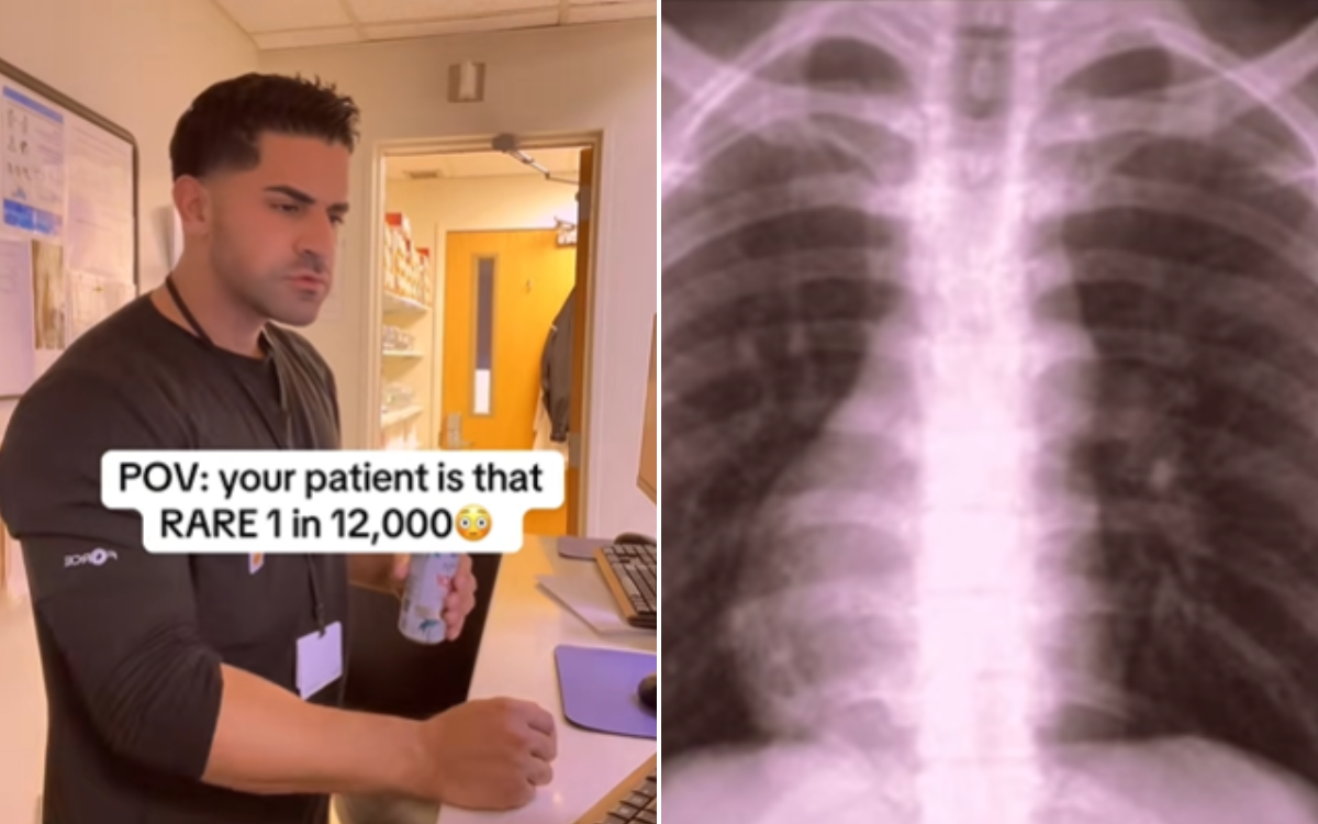 Patient Goes In for Routine X-Ray—Then Radiologist Sees Something So Rare