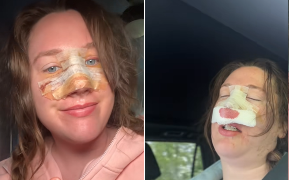 Mom wakes up from anesthesia, totally unprepared for how many kids she gave birth to