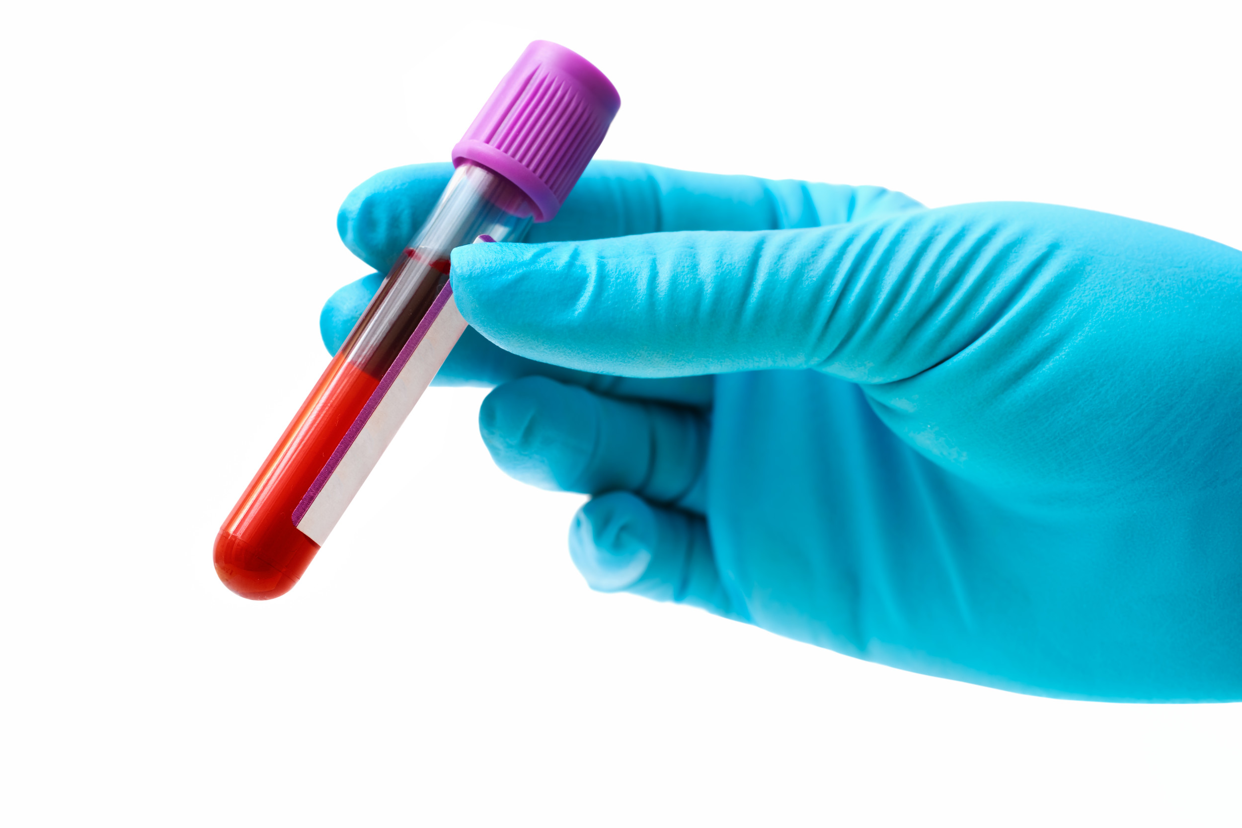 Sangue artificiale compatibile con tutti i gruppi sanguigni in fase di sperimentazione