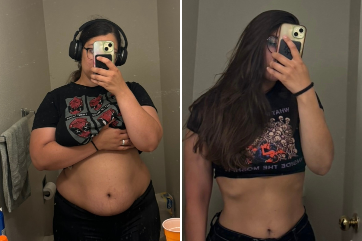 Before/after